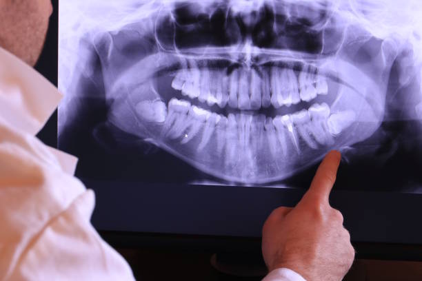 Best Emergency Care for Gum Disease in Portsmouth, NH