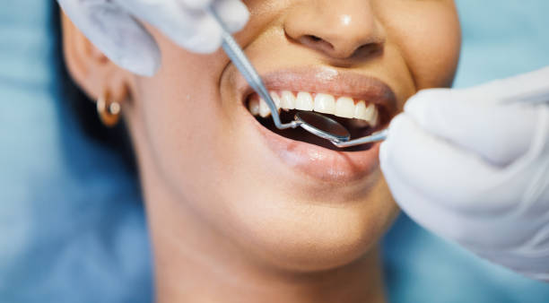 Best Emergency Dental Care for Sports Injuries in Portsmouth, NH
