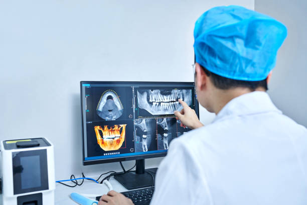 Best Knocked-Out Tooth (Avulsed Tooth) Treatment in Portsmouth, NH